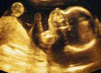 Minik Gurmelerin Şaşırtıcı Tepkileri: Anne Karnında Lahana ve Havuç Denemeleri news-05082024-034236