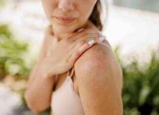 Yazın Cilt Koruma İpuçları ve Güneşten Korunma Yöntemleri news-05082024-034304