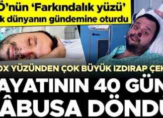 Harun Tulunay: Avrupa’da Mpox Hastalığına Yakalanan İlk Hasta İle Röportaj news-17082024-143907