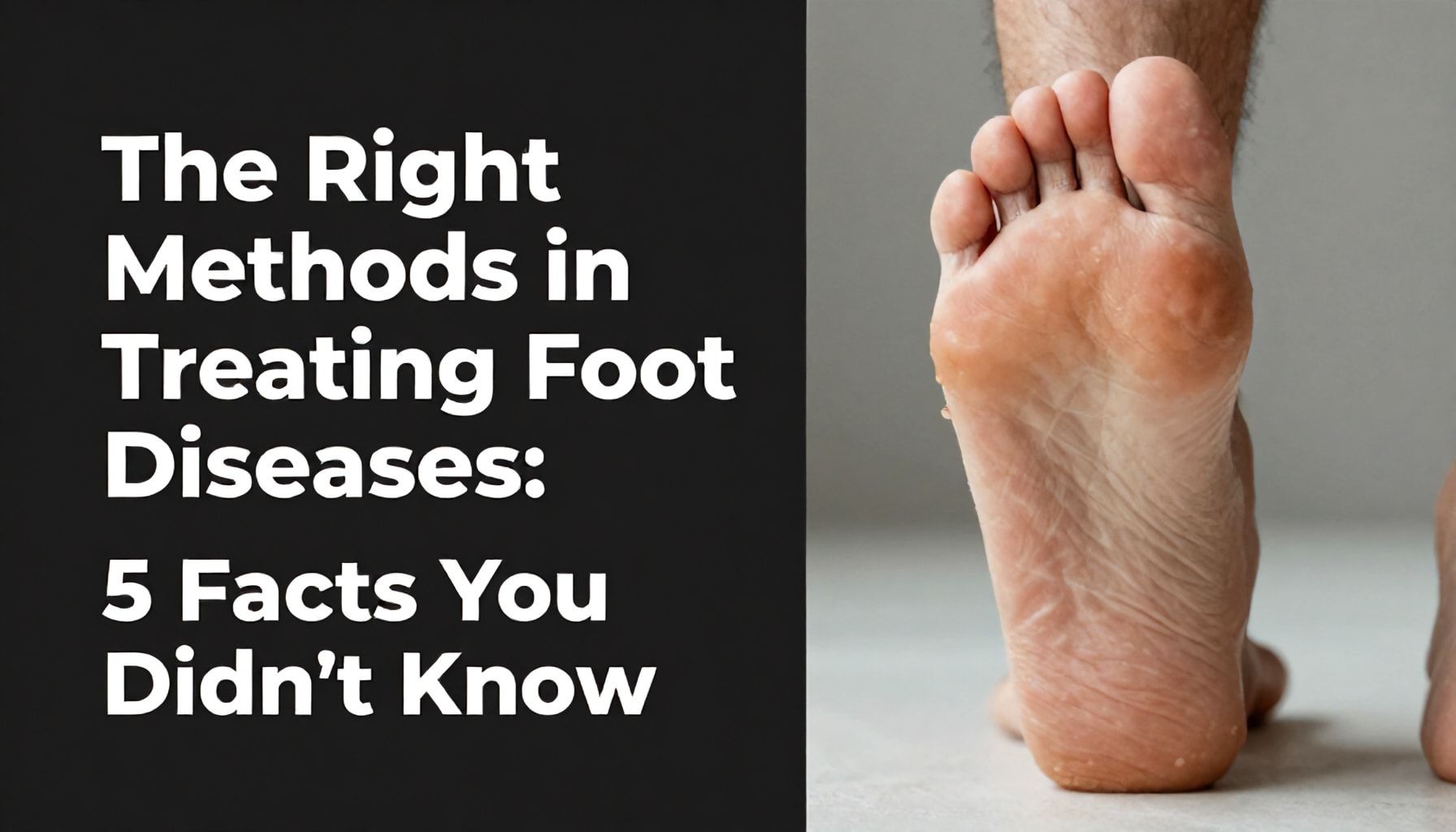 El Ayak Hastalığı Tedavisinde Doğru Yöntemleri: 5 Bilmediğiniz Gerçek*